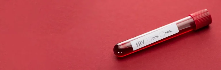 Anticuerpos HIV