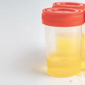 Antidoping 6 Parámetros