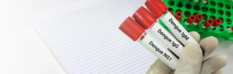 Antigeno NS1 y Anticuerpos IgG e IgM Dengue