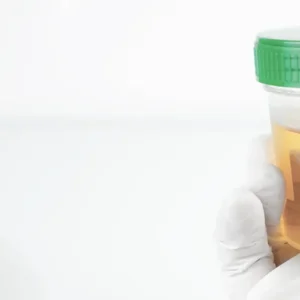 Examen General de Orina