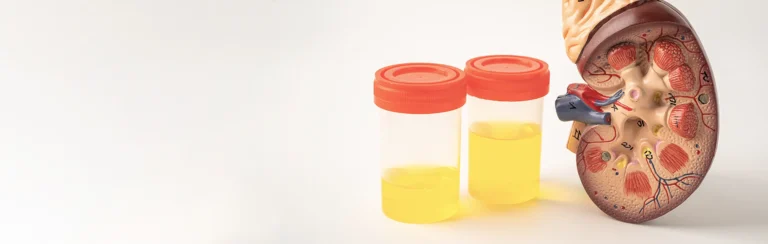 Microalbuminuria