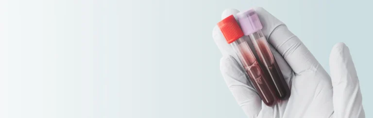 Perfil de Anemia