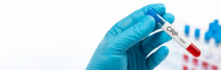 Proteina C Reactiva