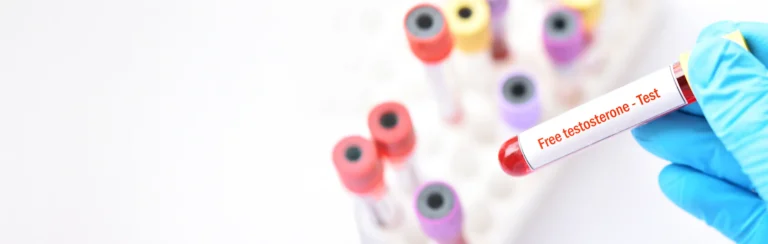 Testosterona Libre