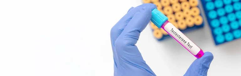 Testosterona Total