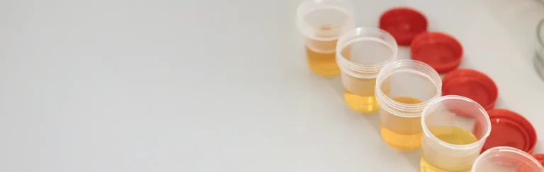 Electrolitos en Orina 3 Elementos