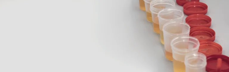 Electrolitos en Orina 6 Elementos